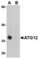 APG12 / ATG12 Antibody (Internal)